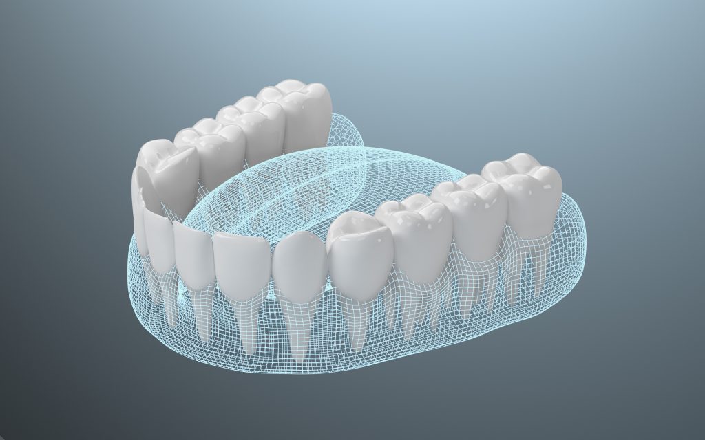 Graphic of lower dentures